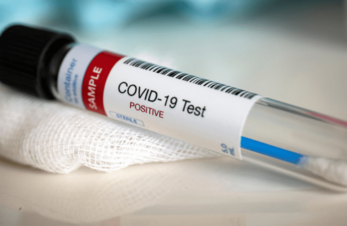 Confirman la tercera muerte por coronavirus en la provincia de Santa Fe